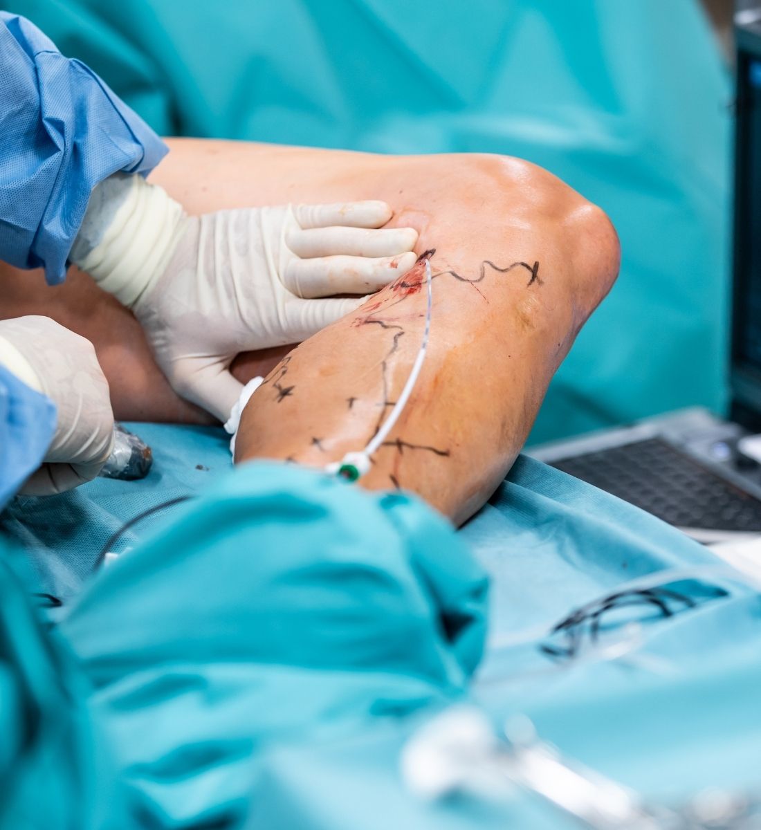 Top General Surgeon in Hyderabad | Advanced Surgical Care