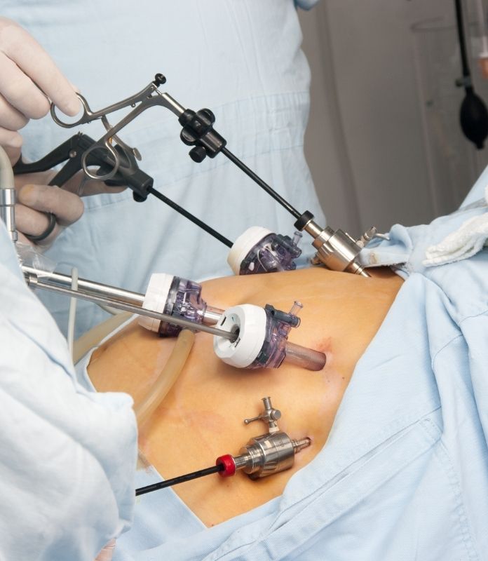 Advanced Fistula Treatment Options in Hyderabad for Faster Healing