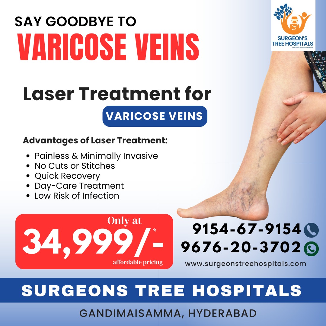 Best Hospital for General Surgery in North Hyderabad – Surgeons