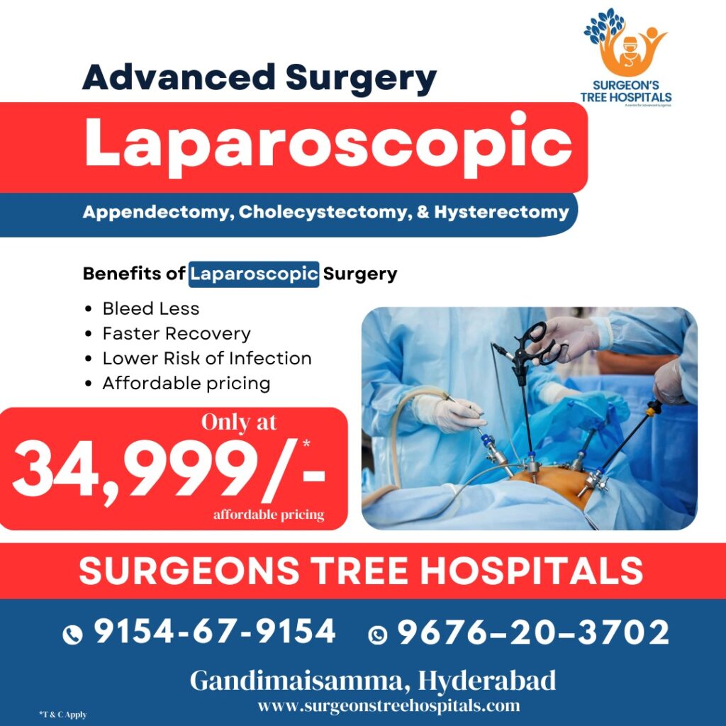 hospital for laparoscopic surgery 